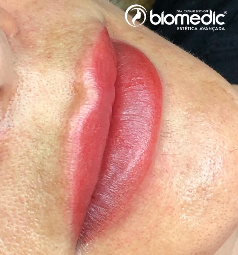 Micropigmentação Labial