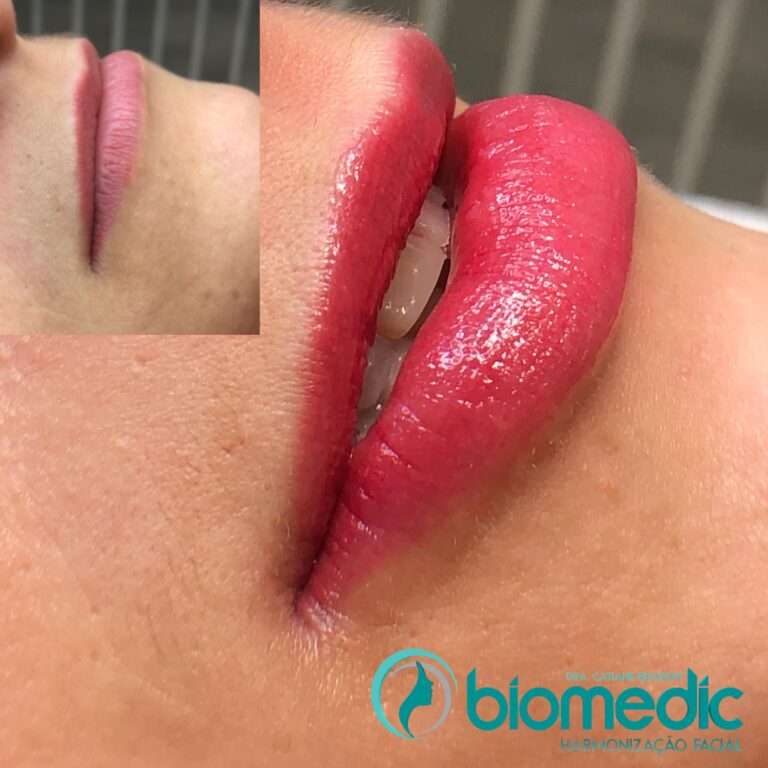 Micropigmentação Labial